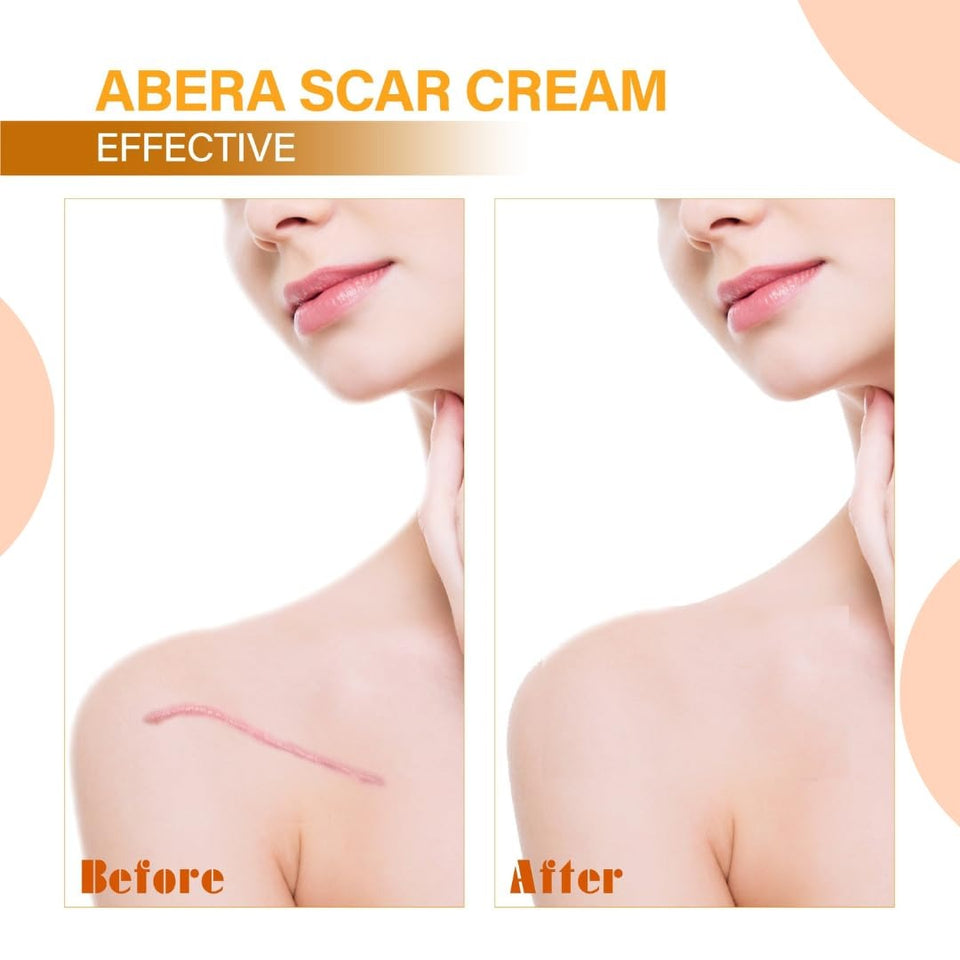 Abera Scar Removal Cream✨